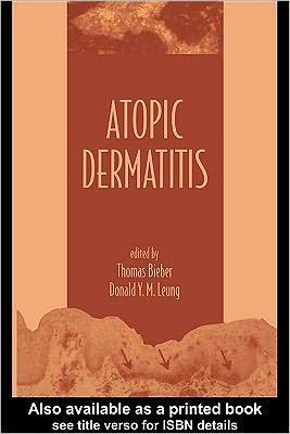 Atopic Dermatitis