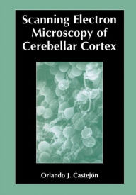 Title: Scanning Electron Microscopy of Cerebellar Cortex / Edition 1, Author: Orlando Castejïn