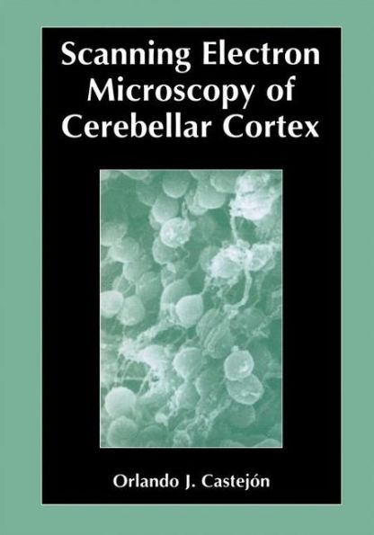 Scanning Electron Microscopy of Cerebellar Cortex / Edition 1