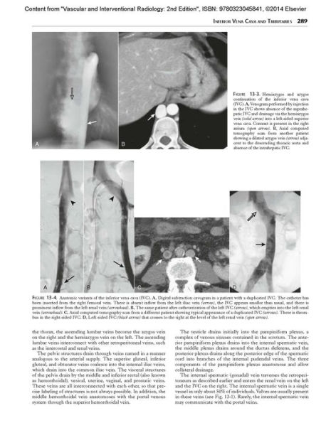 Vascular and Interventional Radiology: The Requisites / Edition 2