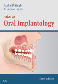 Title: Atlas of Oral Implantology - E-Book, Author: Pankaj Singh