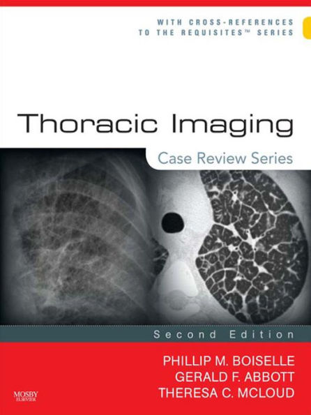 Thoracic Imaging: Case Review Series E-Book