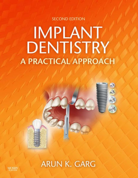 Implant Dentistry - E-Book: Implant Dentistry - E-Book