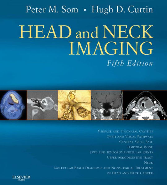 Head and Neck Imaging: Expert Consult- Online and Print