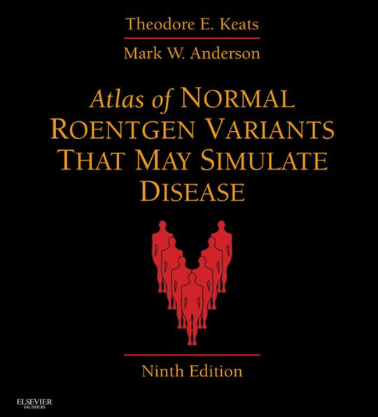 Atlas of Normal Roentgen Variants That May Simulate Disease E-Book