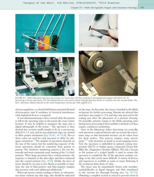 Surgery of the Skin: Procedural Dermatology / Edition 3