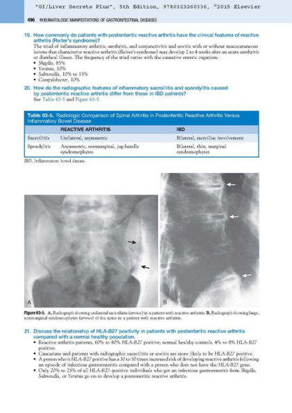 GI/Liver Secrets Plus / Edition 5