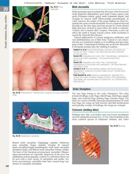 Andrews' Diseases of the Skin: Clinical Dermatology / Edition 12