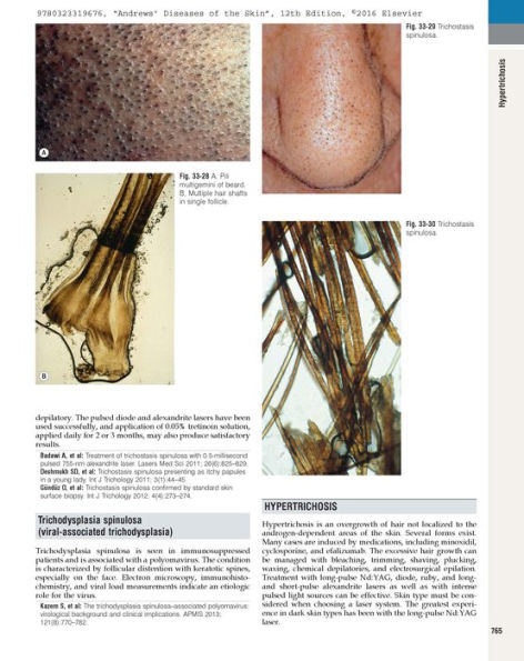 Andrews' Diseases of the Skin: Clinical Dermatology / Edition 12