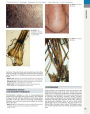 Alternative view 3 of Andrews' Diseases of the Skin: Clinical Dermatology / Edition 12