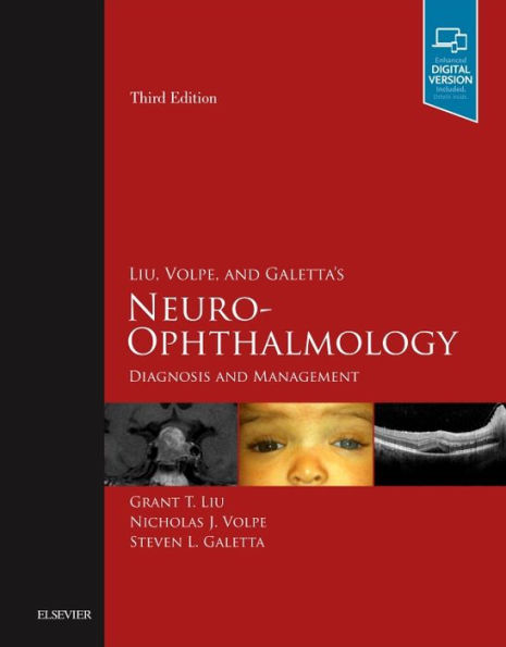 Liu, Volpe, and Galetta's Neuro-Ophthalmology: Diagnosis and Management / Edition 3