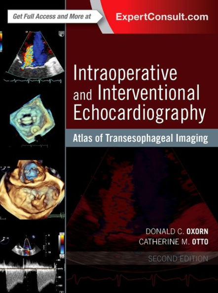 Intraoperative and Interventional Echocardiography: Atlas of Transesophageal Imaging / Edition 2