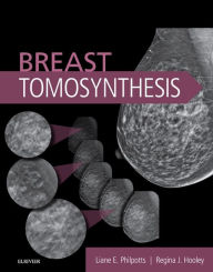 Title: Breast Tomosynthesis, Author: Liane E Philpotts MD