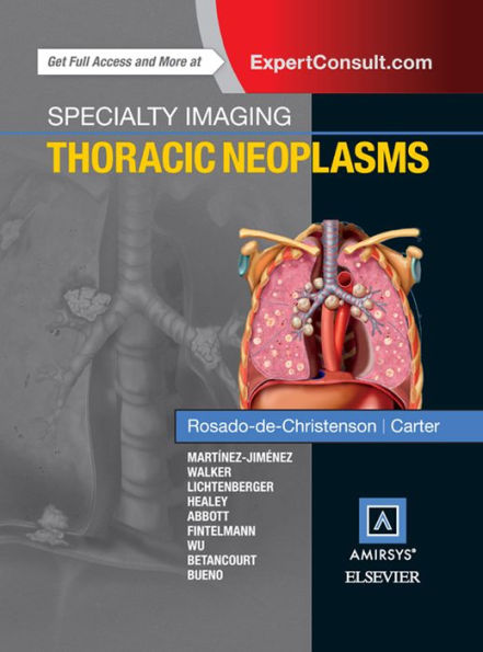 Specialty Imaging: Thoracic Neoplasms E-Book: Specialty Imaging: Thoracic Neoplasms E-Book