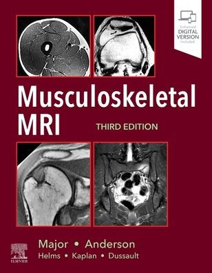 Musculoskeletal MRI / Edition 3