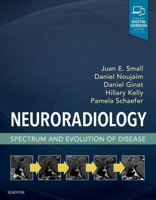 Neuroradiology: Spectrum and Evolution of Disease