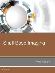 Title: Skull Base Imaging, Author: Vincent Chong