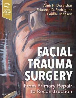 Facial Trauma Surgery: From Primary Repair to Reconstruction