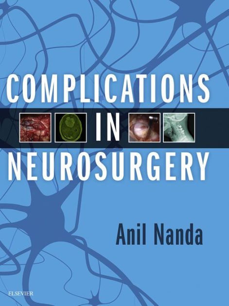 Complications in Neurosurgery by Anil Nanda MD, MPH, FACS ...