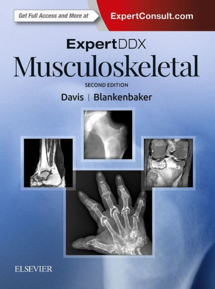ExpertDDx: Musculoskeletal / Edition 2
