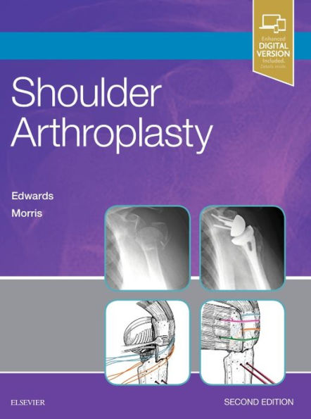 Shoulder Arthroplasty / Edition 2