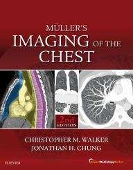 Title: Muller's Imaging of the Chest: Expert Radiology Series, Author: Christopher M. Walker MD