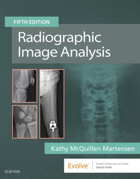 Radiographic Image Analysis E-Book: Radiographic Image Analysis E-Book