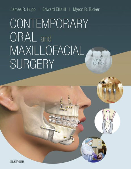 Contemporary Oral and Maxillofacial Surgery E-Book: Contemporary Oral and Maxillofacial Surgery E-Book