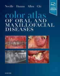 Title: Color Atlas of Oral and Maxillofacial Diseases, Author: Brad W. Neville DDS