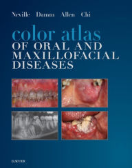 Title: Color Atlas of Oral and Maxillofacial Diseases: Color Atlas of Oral and Maxillofacial Diseases - E-Book, Author: Brad W. Neville DDS