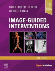 Ebook gratuiti italiano download Image-Guided Interventions: Expert Radiology Series / Edition 3 9780323612043 English version  by Matthew A. Mauro MD, FACR, Kieran P.J. Murphy MB, FRCPC, FSIR, Kenneth R. Thomson MD, FRANZCR, Anthony C. Venbrux MD, Robert A. Morgan MBChB, MRCP, FRCR, EBIR