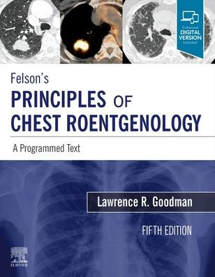 Felson's Principles of Chest Roentgenology, A Programmed Text: A Programmed Text