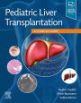 Pediatric Liver Transplantation: A Clinical Guide