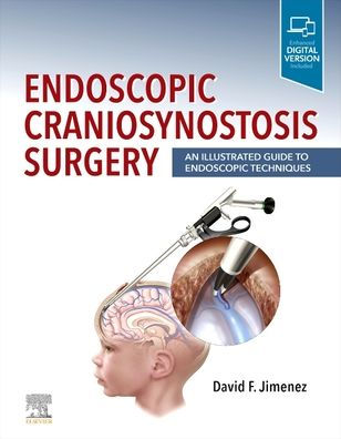 Endoscopic Craniosynostosis Surgery: An Illustrated Guide to Endoscopic Techniques