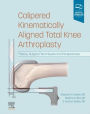 Calipered Kinematically aligned Total Knee Arthroplasty: Theory, Surgical Techniques and Perspectives
