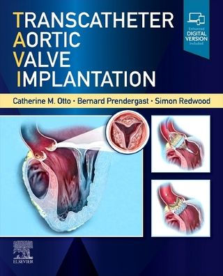 Transcatheter Aortic Valve Implantation