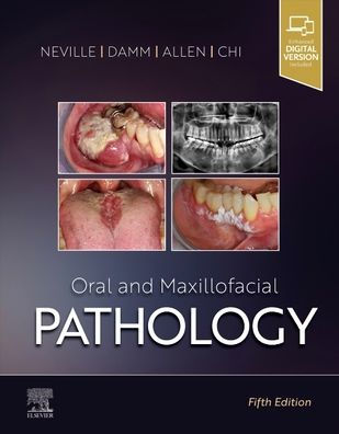 Oral and Maxillofacial Pathology