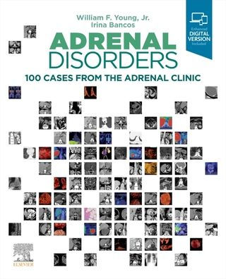 Adrenal Disorders: 100 Cases from the Clinic