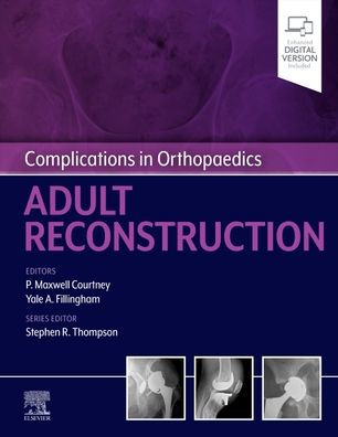 Complications Orthopaedics: Adult Reconstruction