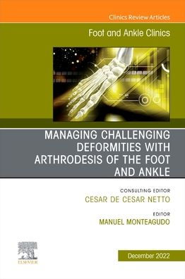 Managing Challenging deformities with arthrodesis of the Foot and ankle, An issue Ankle Clinics North America