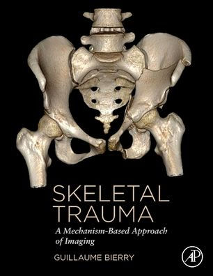Skeletal Trauma: A Mechanism-Based Approach of Imaging
