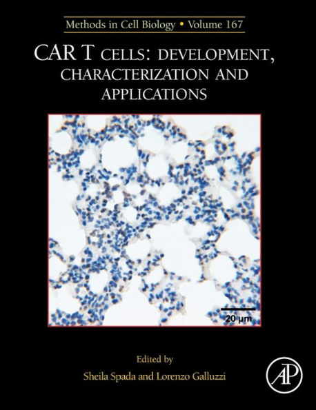 MCB: CAR T Cells: Development, Characterization and Applications