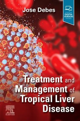 Treatment and Management of Tropical Liver Disease