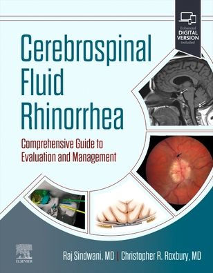 Cerebrospinal Fluid Rhinorrhea: Comprehensive Guide to Evaluation and Management