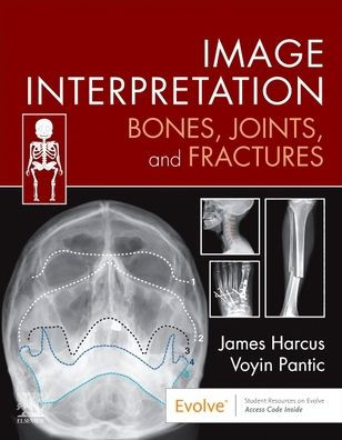 Image Interpretation: Bones, Joints, and Fractures