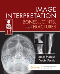 Title: Image Interpretation: Bones, Joints, and Fractures - E-Book: Image Interpretation: Bones, Joints, and Fractures - E-Book, Author: James Harcus