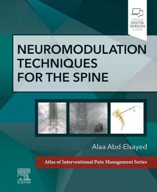 Neuromodulation Techniques for the Spine: A Volume Atlas of Interventional Pain Management Series