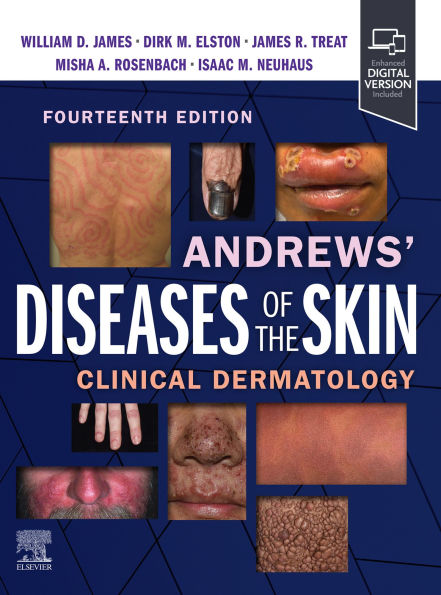 Andrews' Diseases of the Skin E-Book: Clinical Dermatology
