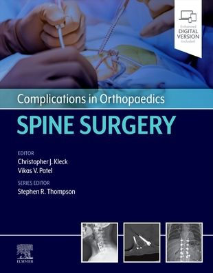 Complications in Orthopaedics: Spine Surgery