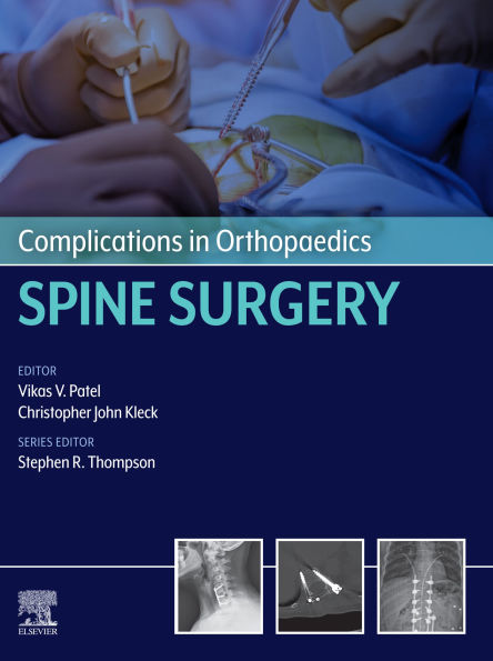 Complications in Orthopaedics: Spine Surgery